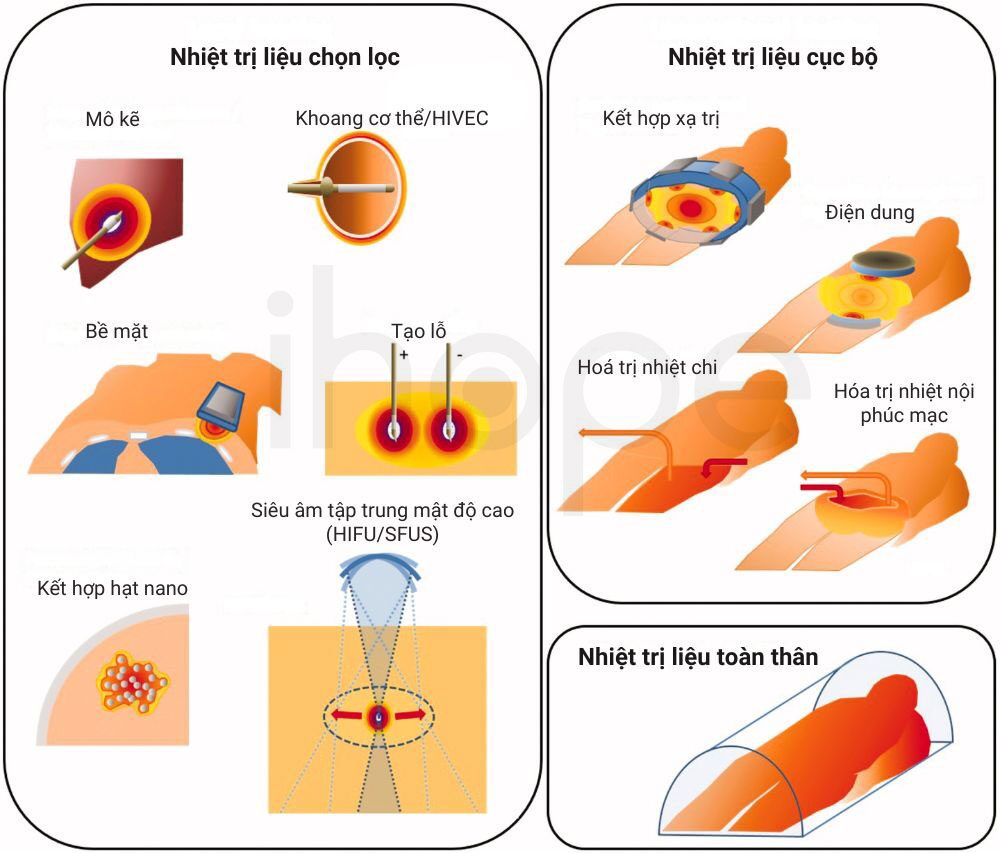 Tìm hiểu về Nhiệt liệu pháp ứng dụng chăm sóc sức khỏe chủ động